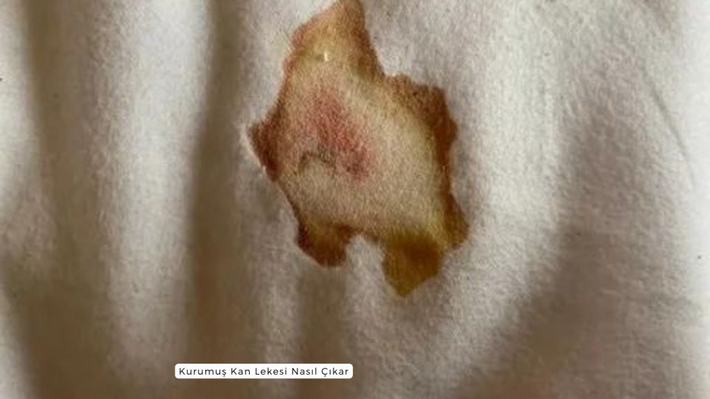 Kurumuş Kan Lekesi Nasıl Çıkar